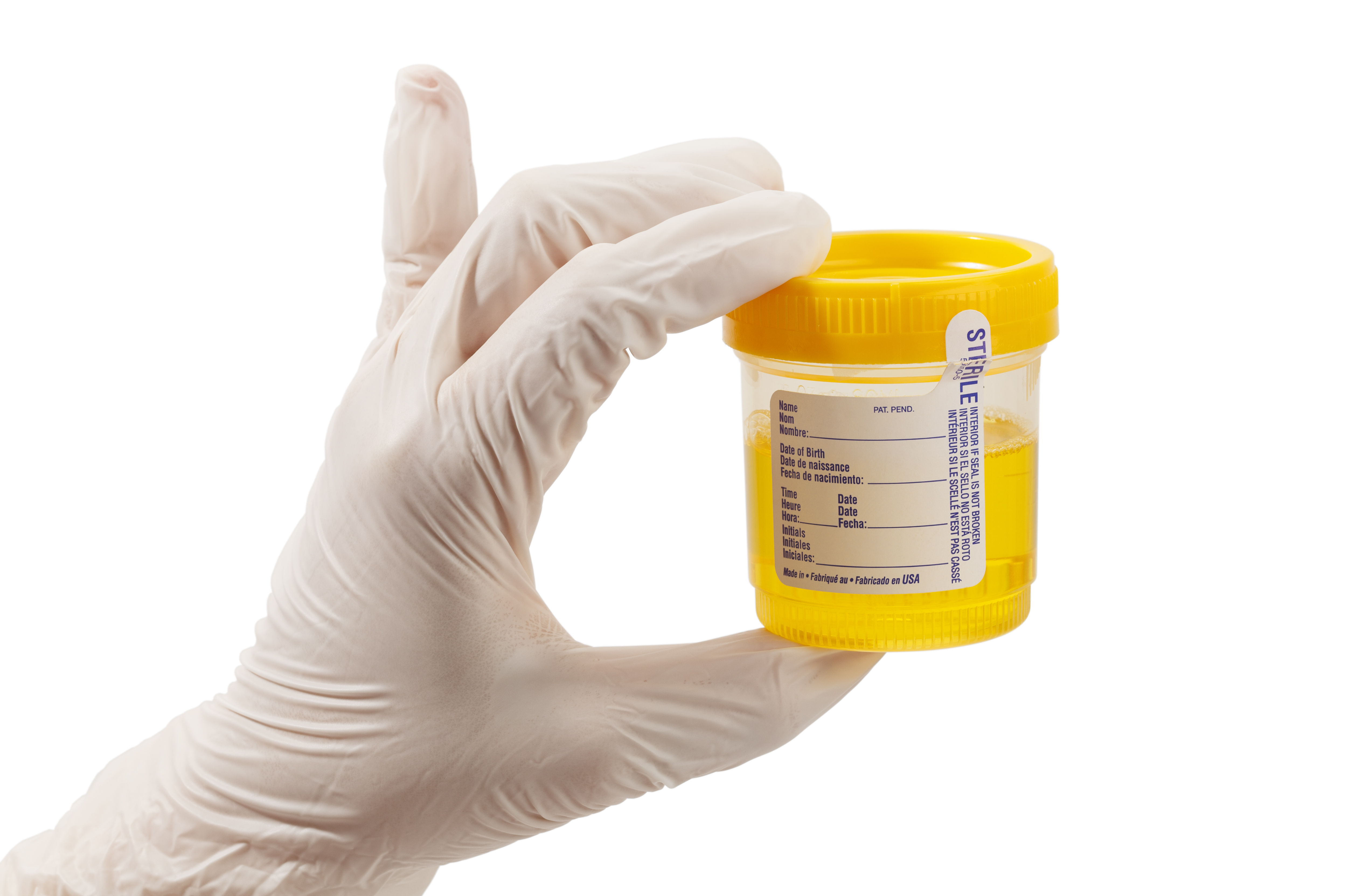 Lab Urine Drug Test